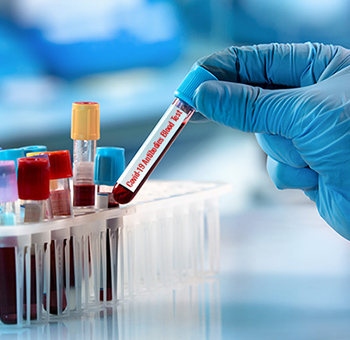 Antibodies Blood Test